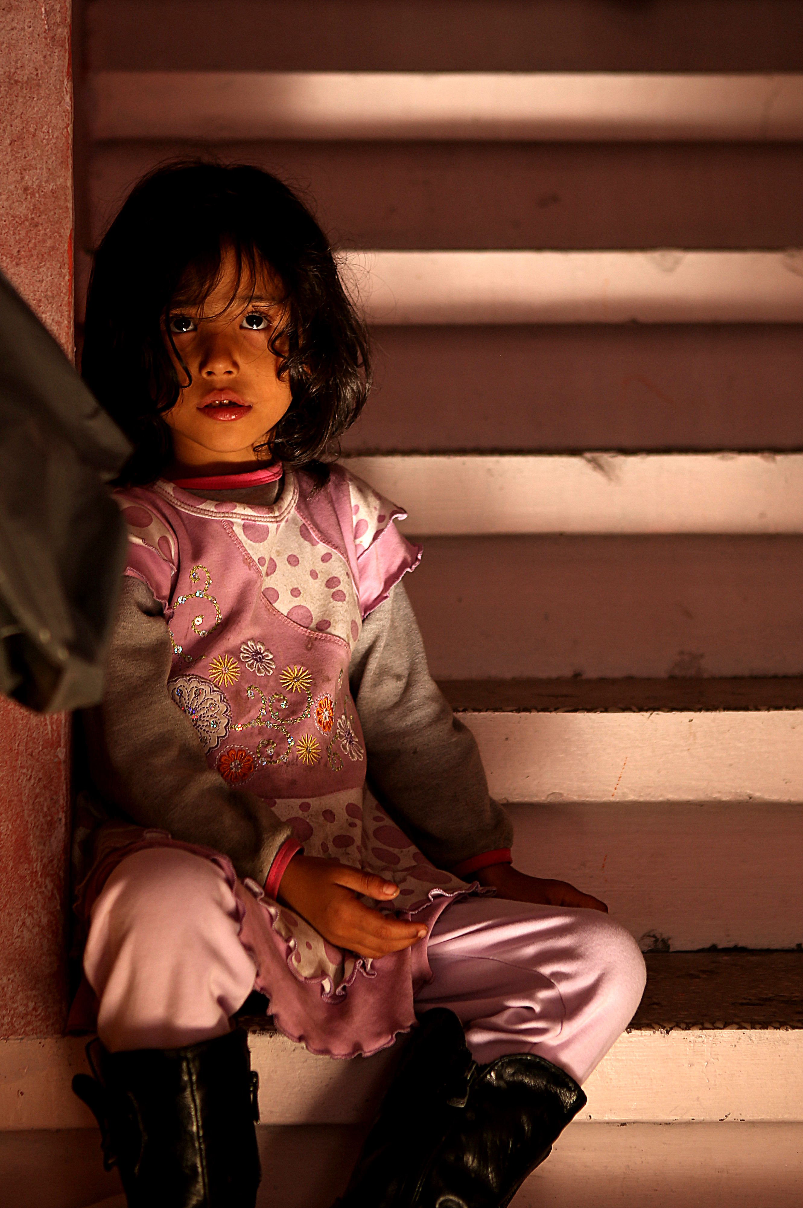Balat ışığı